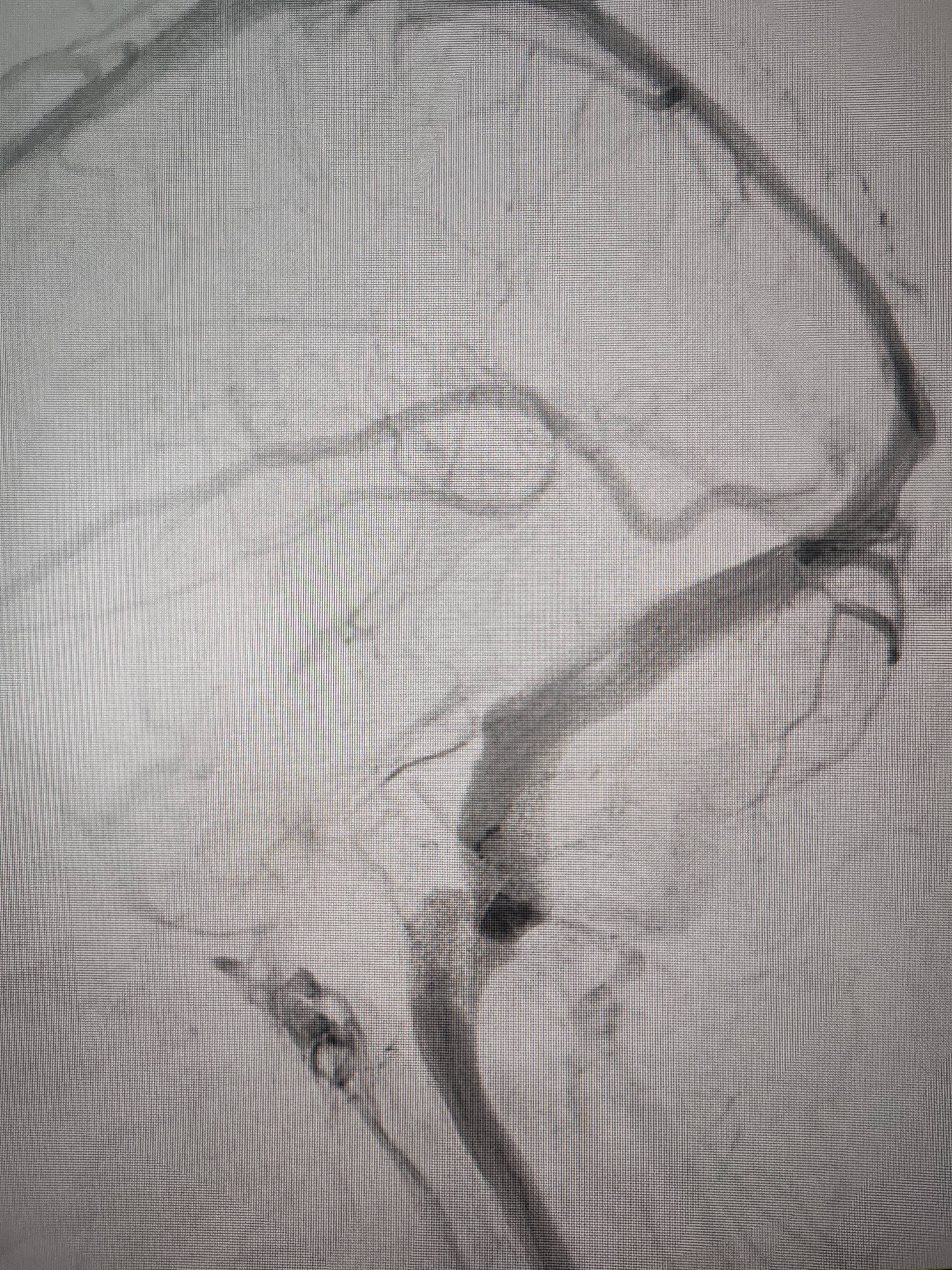 吉林女子患罕见耳鸣7年,慕名千里来顺德寻医终获新生