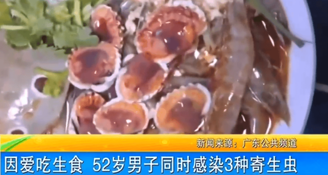 女子体内排出10米长绦虫!原是两年前旅游时吃了这种食物