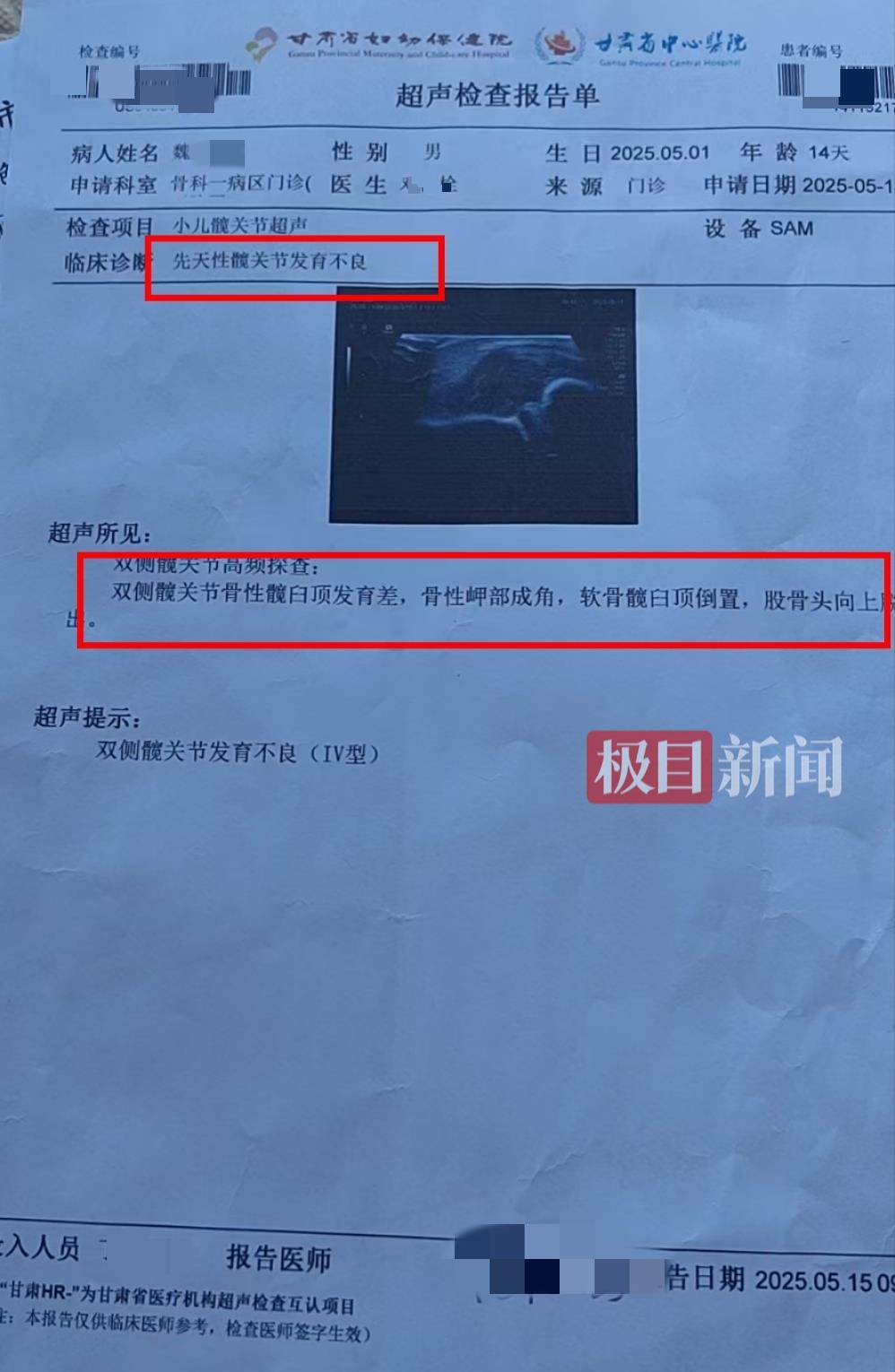 二胎出生查出先天性病症或落下残疾,残疾父母称医院产检漏检、未尽告知义务,医院及医调委回应