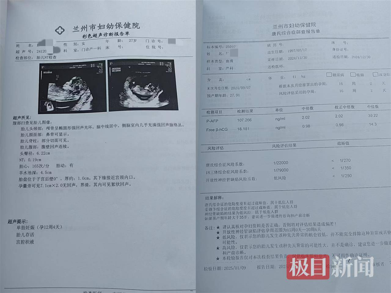 二胎出生查出先天性病症或落下残疾,残疾父母称医院产检漏检、未尽告知义务,医院及医调委回应