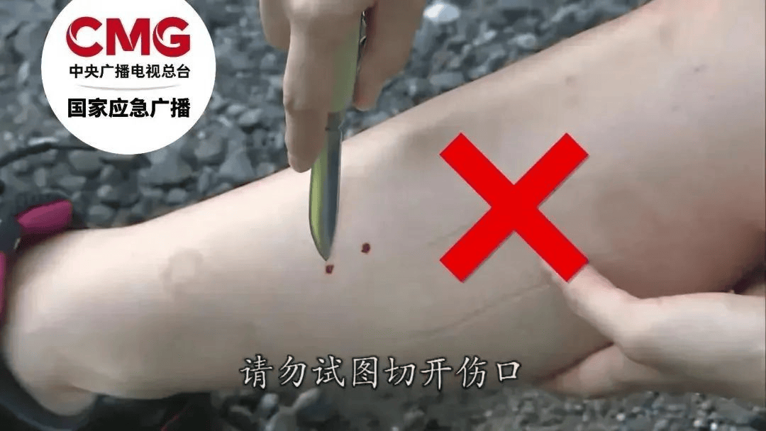 游客三亚疑被蛇咬身亡,当地曾公布3家医院有抗蛇毒血清