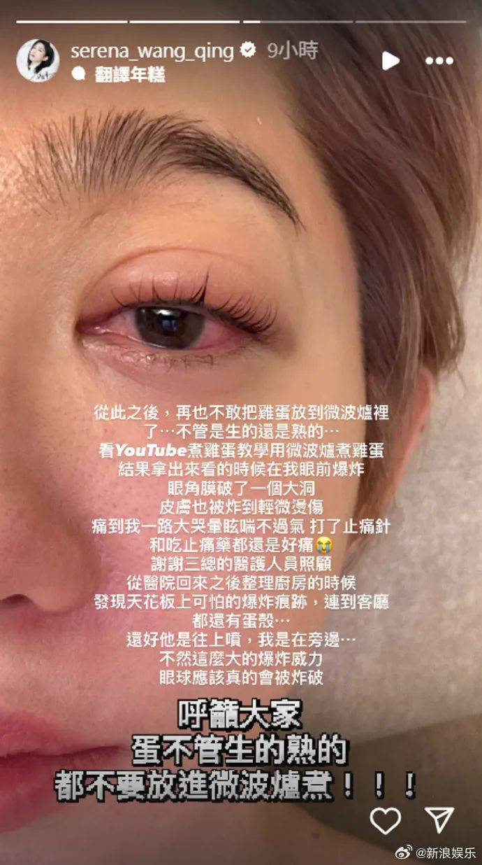 突然爆炸！知名女演员自曝：痛到大哭眩晕