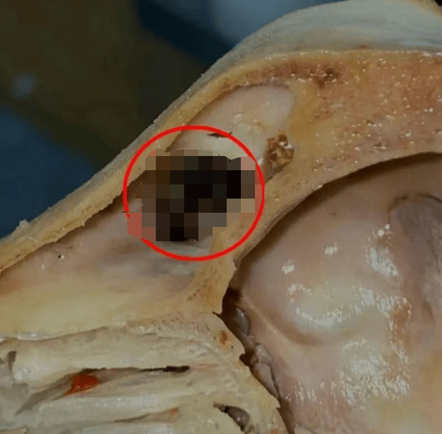 吃完发现全是蛆,恶心呕吐一整夜!上海法院判了:赔1000元