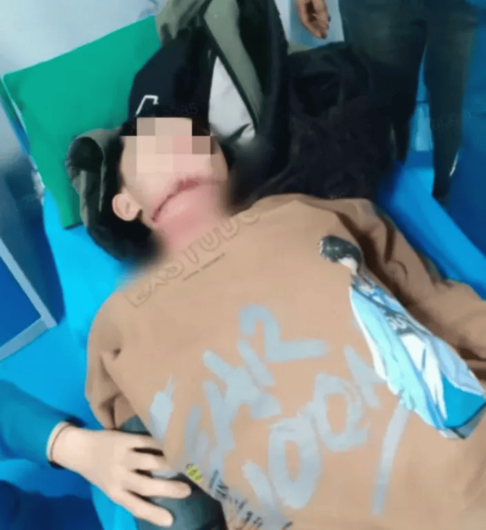 “13岁男孩路上遭绳子割喉”，最新后续